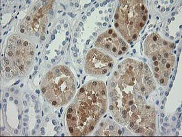 NDEL1 Antibody in Immunohistochemistry (Paraffin) (IHC (P))