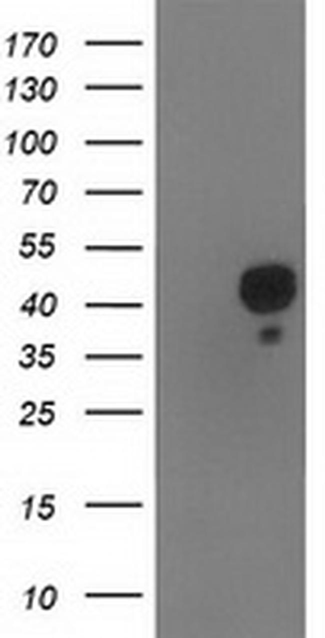 NDEL1 Antibody in Western Blot (WB)