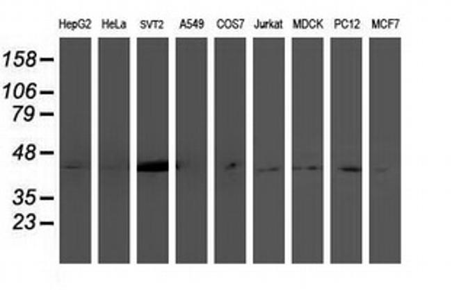 NDEL1 Antibody in Western Blot (WB)