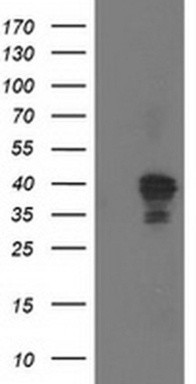 NDEL1 Antibody in Western Blot (WB)