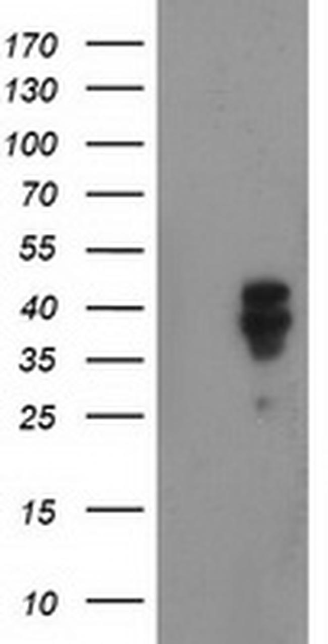 NDEL1 Antibody in Western Blot (WB)