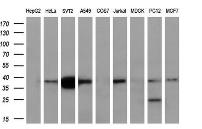 NDEL1 Antibody in Western Blot (WB)