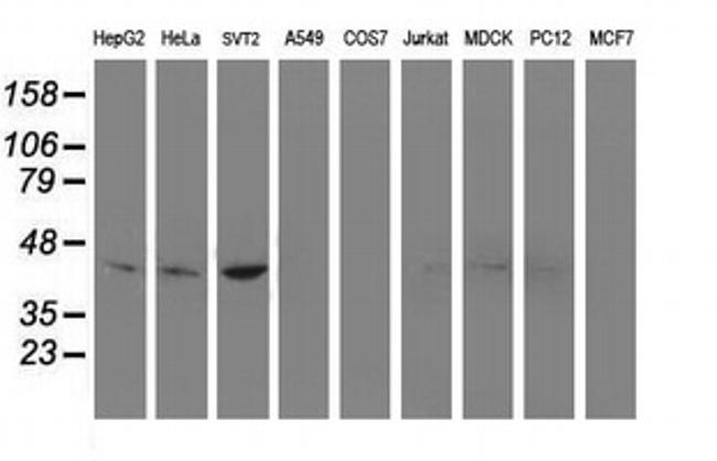 NDEL1 Antibody in Western Blot (WB)