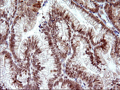 NDN Antibody in Immunohistochemistry (Paraffin) (IHC (P))