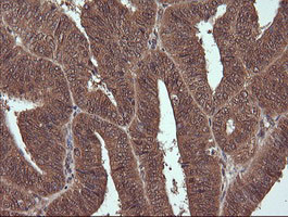 NDOR1 Antibody in Immunohistochemistry (Paraffin) (IHC (P))