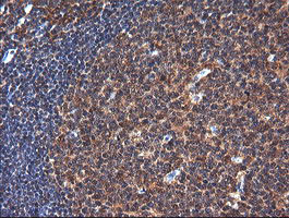 NDOR1 Antibody in Immunohistochemistry (Paraffin) (IHC (P))