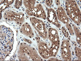 NDOR1 Antibody in Immunohistochemistry (Paraffin) (IHC (P))