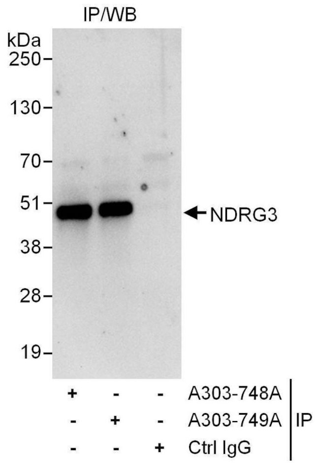 NDRG3 Antibody in Immunoprecipitation (IP)