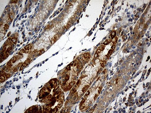 NDUFA2 Antibody in Immunohistochemistry (Paraffin) (IHC (P))