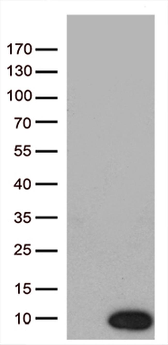 NDUFA2 Antibody in Western Blot (WB)