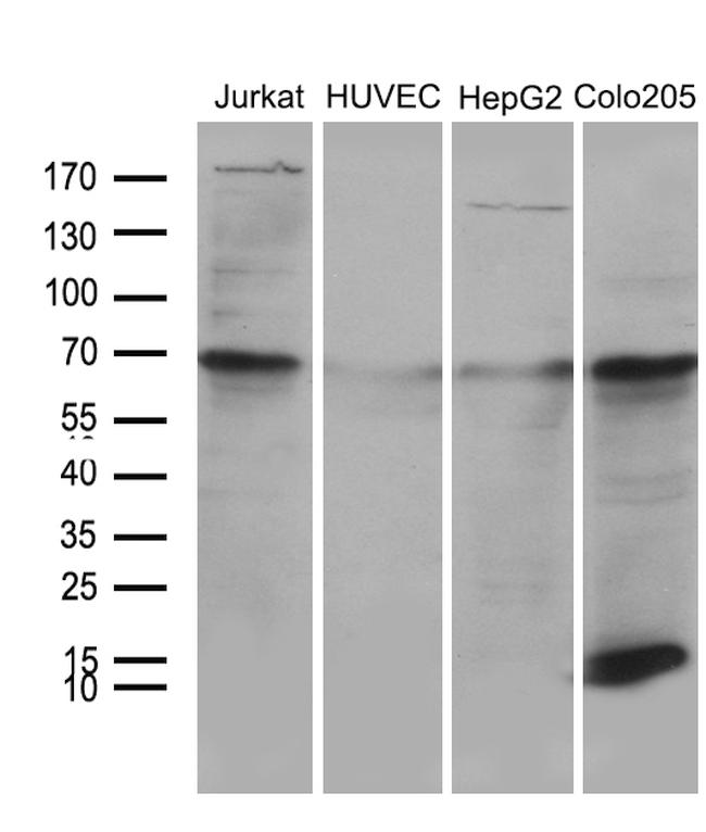 NDUFA4L2 Antibody in Western Blot (WB)