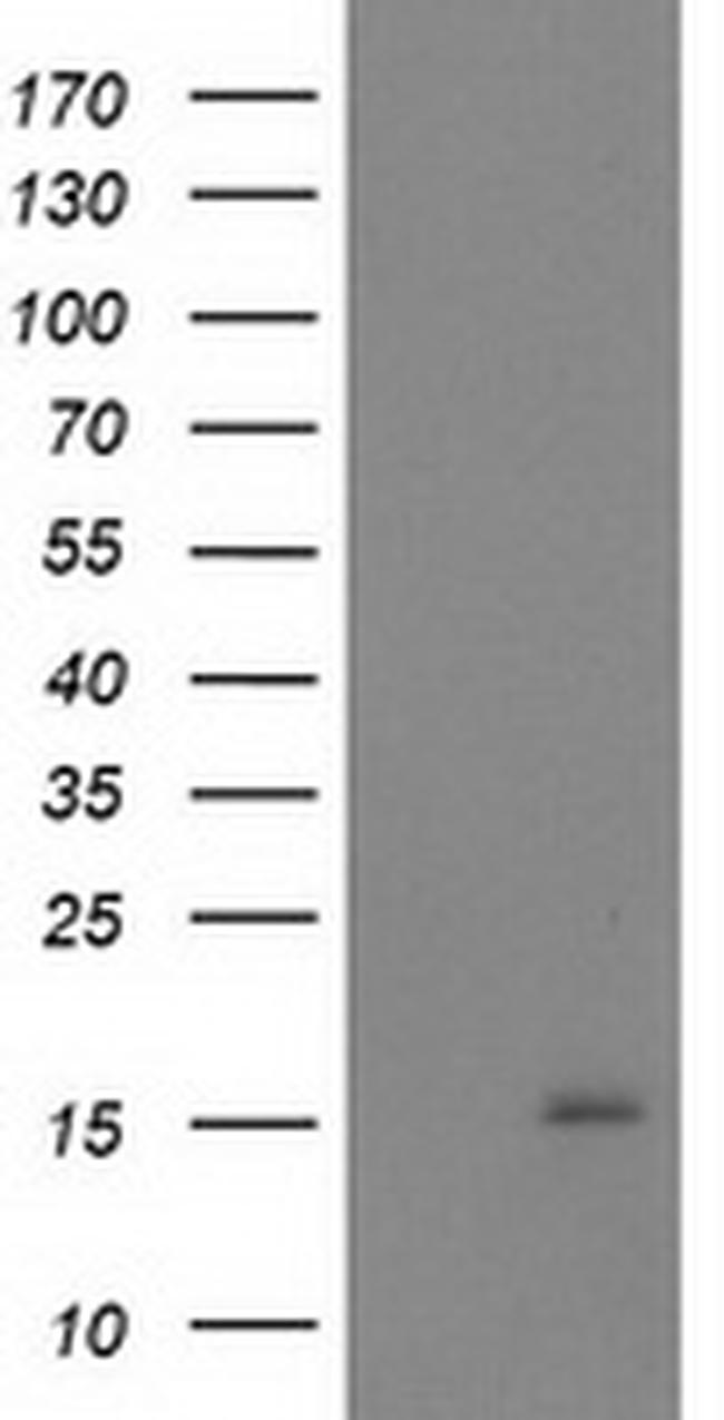 NDUFA7 Antibody in Western Blot (WB)