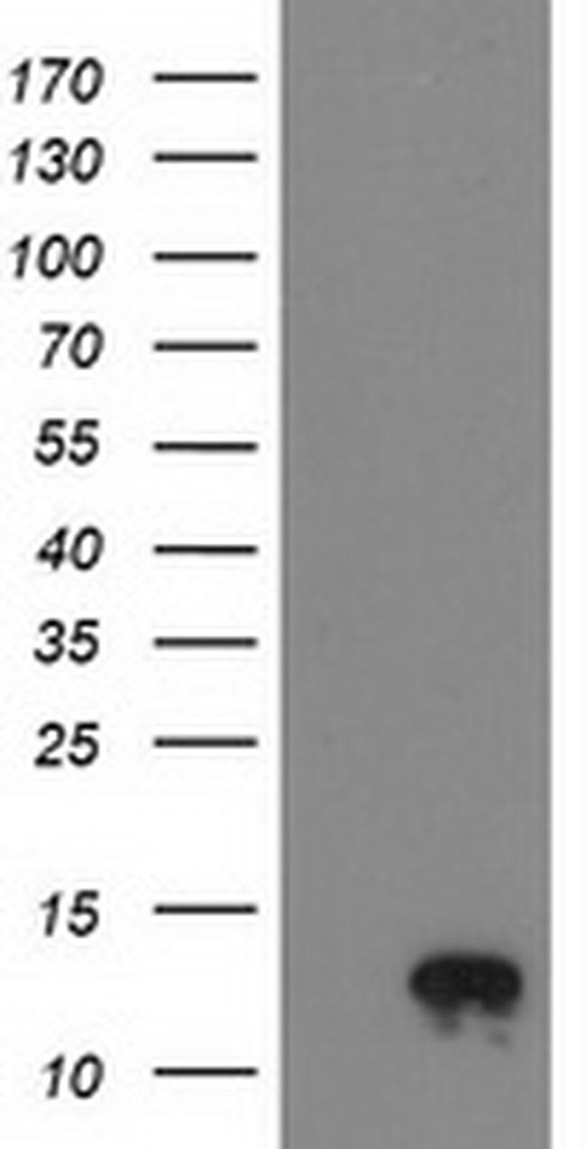 NDUFA7 Antibody in Western Blot (WB)