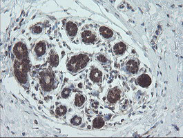 NDUFB10 Antibody in Immunohistochemistry (Paraffin) (IHC (P))