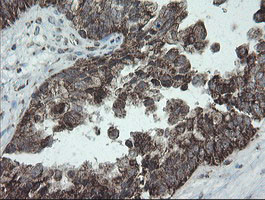 NDUFB10 Antibody in Immunohistochemistry (Paraffin) (IHC (P))