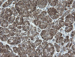 NDUFB10 Antibody in Immunohistochemistry (Paraffin) (IHC (P))