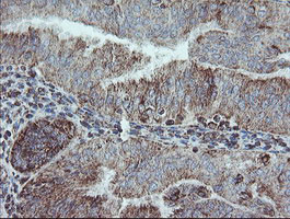 NDUFB10 Antibody in Immunohistochemistry (Paraffin) (IHC (P))