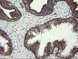 NDUFB10 Antibody in Immunohistochemistry (Paraffin) (IHC (P))