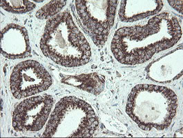 NDUFB10 Antibody in Immunohistochemistry (Paraffin) (IHC (P))