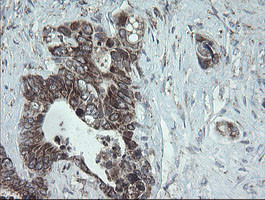 NDUFB10 Antibody in Immunohistochemistry (Paraffin) (IHC (P))