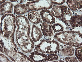 NDUFB10 Antibody in Immunohistochemistry (Paraffin) (IHC (P))