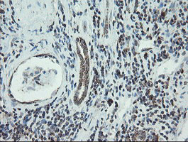 NDUFB10 Antibody in Immunohistochemistry (Paraffin) (IHC (P))