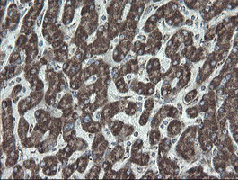 NDUFB10 Antibody in Immunohistochemistry (Paraffin) (IHC (P))