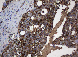 NDUFB10 Antibody in Immunohistochemistry (Paraffin) (IHC (P))