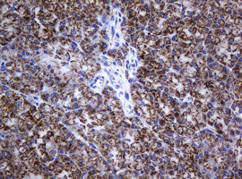 NDUFB10 Antibody in Immunohistochemistry (Paraffin) (IHC (P))