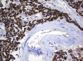 NDUFB10 Antibody in Immunohistochemistry (Paraffin) (IHC (P))