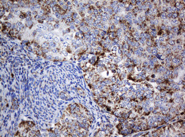 NDUFB10 Antibody in Immunohistochemistry (Paraffin) (IHC (P))