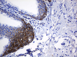 NDUFB10 Antibody in Immunohistochemistry (Paraffin) (IHC (P))