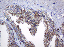 NDUFB10 Antibody in Immunohistochemistry (Paraffin) (IHC (P))