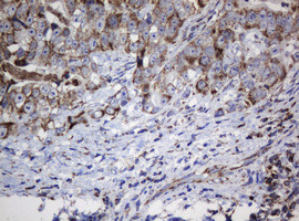 NDUFB10 Antibody in Immunohistochemistry (Paraffin) (IHC (P))