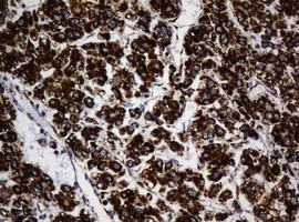 NDUFB10 Antibody in Immunohistochemistry (Paraffin) (IHC (P))