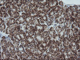 NDUFB10 Antibody in Immunohistochemistry (Paraffin) (IHC (P))