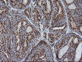 NDUFB10 Antibody in Immunohistochemistry (Paraffin) (IHC (P))