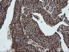 NDUFB10 Antibody in Immunohistochemistry (Paraffin) (IHC (P))