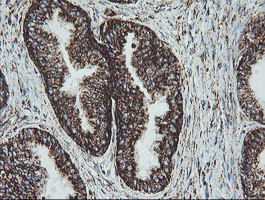 NDUFB10 Antibody in Immunohistochemistry (Paraffin) (IHC (P))