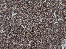 NDUFB10 Antibody in Immunohistochemistry (Paraffin) (IHC (P))