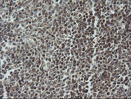 NDUFB10 Antibody in Immunohistochemistry (Paraffin) (IHC (P))