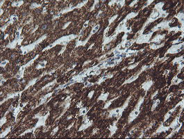 NDUFB10 Antibody in Immunohistochemistry (Paraffin) (IHC (P))