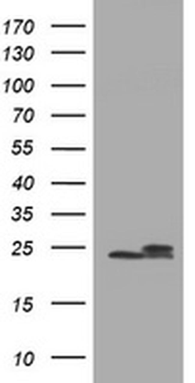 NDUFB10 Antibody in Western Blot (WB)