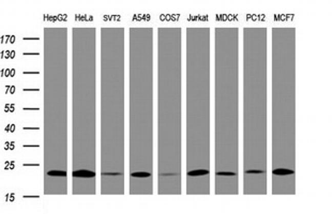 NDUFB10 Antibody in Western Blot (WB)