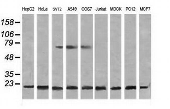 NDUFB10 Antibody in Western Blot (WB)