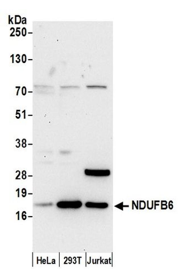 NDUFB6 Antibody in Western Blot (WB)