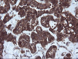 NDUFB9 Antibody in Immunohistochemistry (Paraffin) (IHC (P))