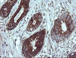 NDUFB9 Antibody in Immunohistochemistry (Paraffin) (IHC (P))