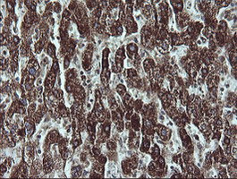 NDUFB9 Antibody in Immunohistochemistry (Paraffin) (IHC (P))