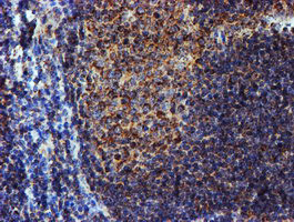 NDUFB9 Antibody in Immunohistochemistry (Paraffin) (IHC (P))